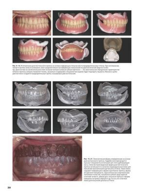 Накагоми Тасио ''Стандарт полного съемного зубного протеза'' Стом. издания