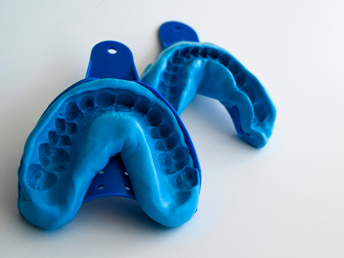 Риски деформации традиционного физического слепка