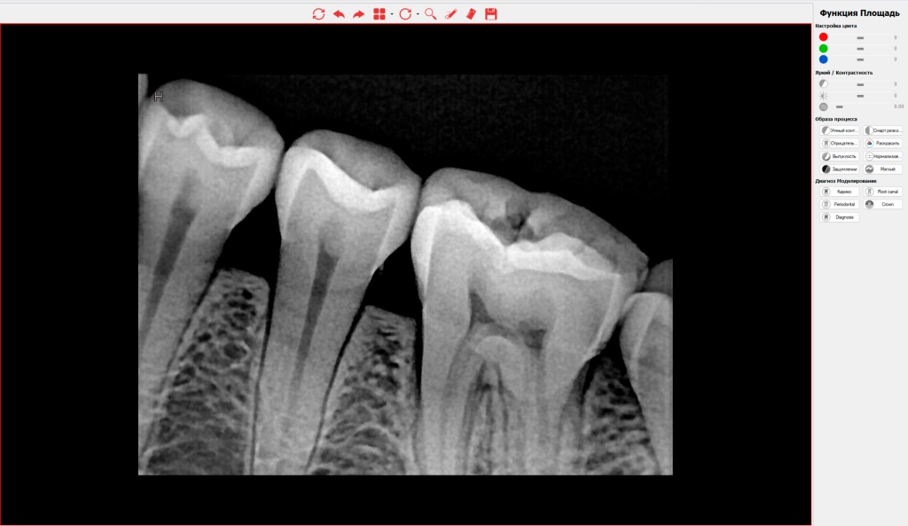 Работа с базой пациентов в программе