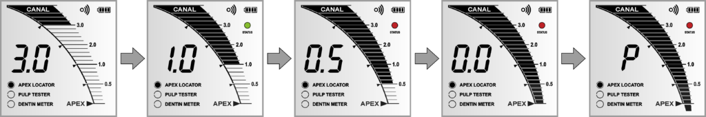 Интерфейс режима Апекслокатор ЭндоЭст-3Д