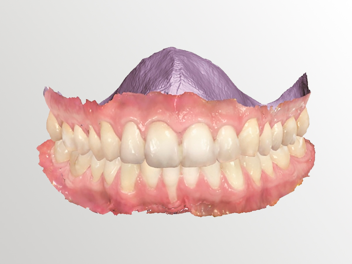 Высокоточная цифровая 3D модель челюсти