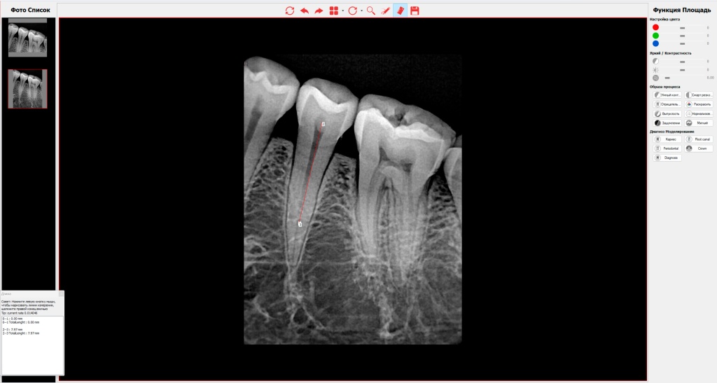 Фильтры и лупа в программе HandyDentist