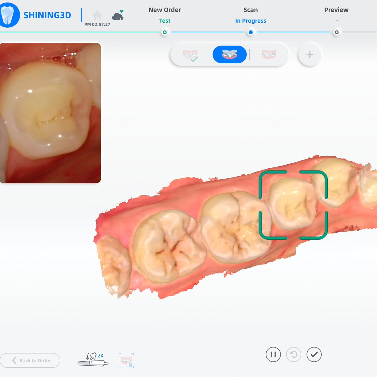 Интеллектуальный подход ПО Aoralscan Lync
