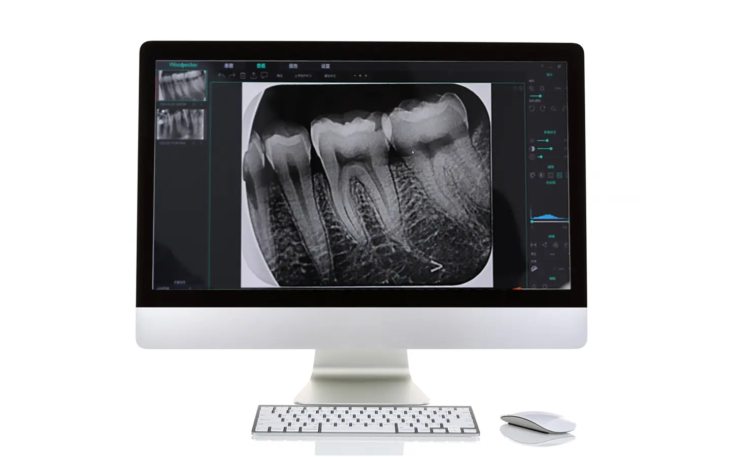 Японская рентгеновская трубка Canon в аппарате DTE Ai-Ray