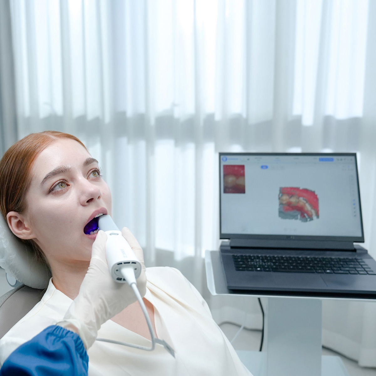 Максимальная точность сканирования Aoralscan Lync