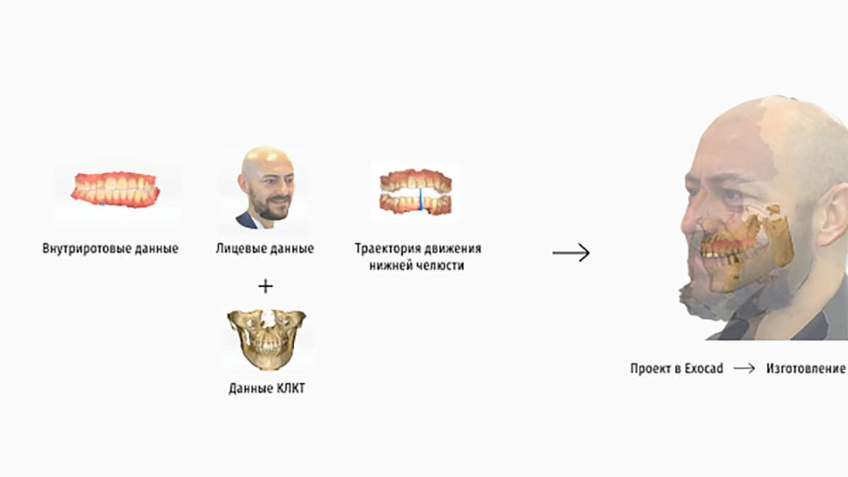 Интерфейс мощного программного обеспечения MetiSmileMR для создания виртуального портрета