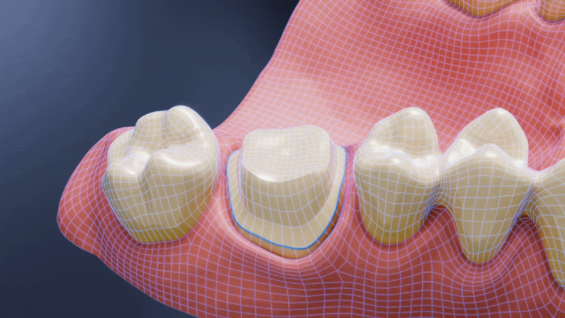 Dental AI Design
