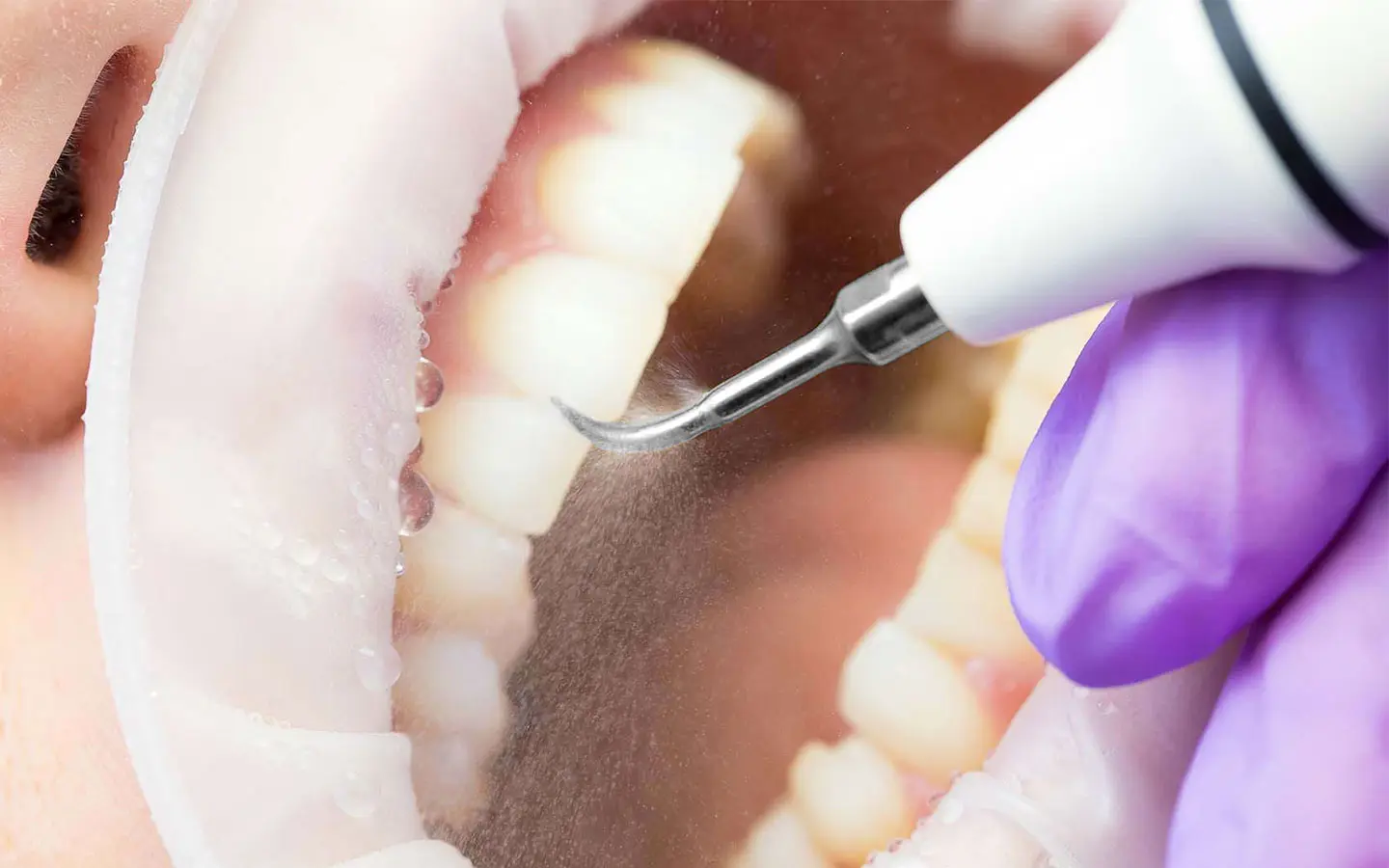 Области применения встраиваемого скалера