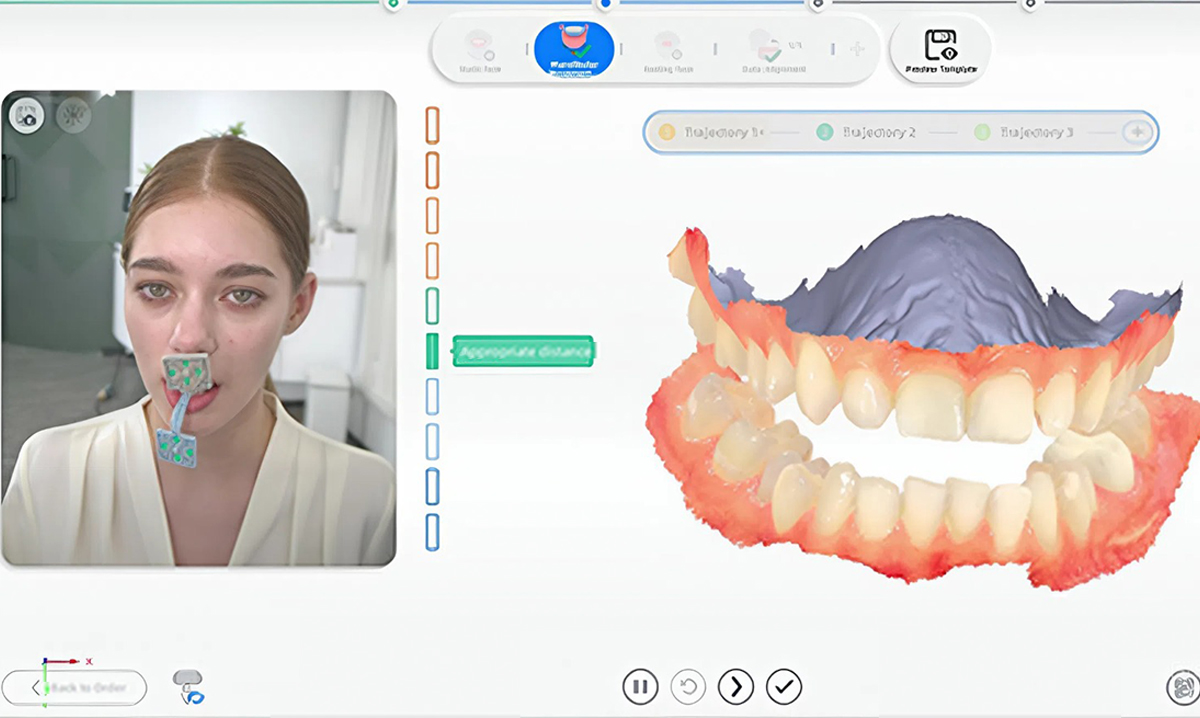 Отслеживание траектории движений челюсти в программе
