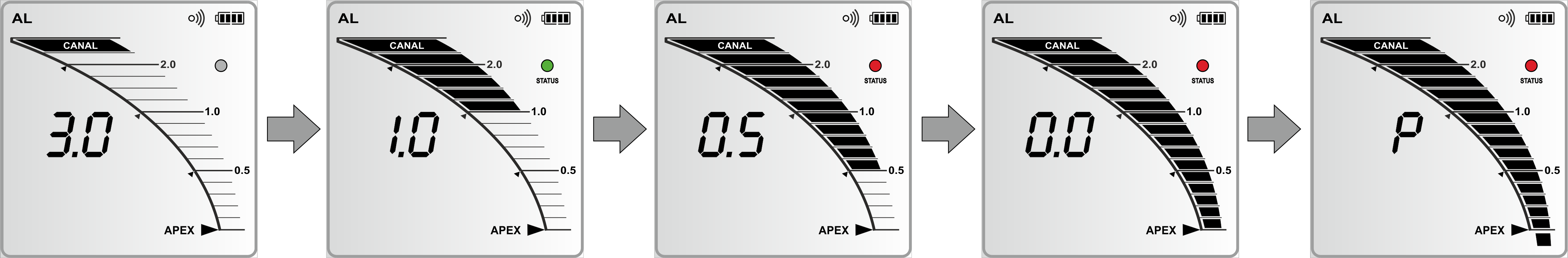 Интерфейс режима Апекслокатор ЭндоЭст-5F