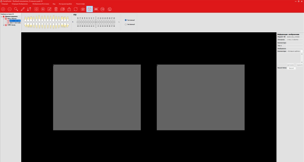 Выбор стоматологической серии снимков в HandyDentist