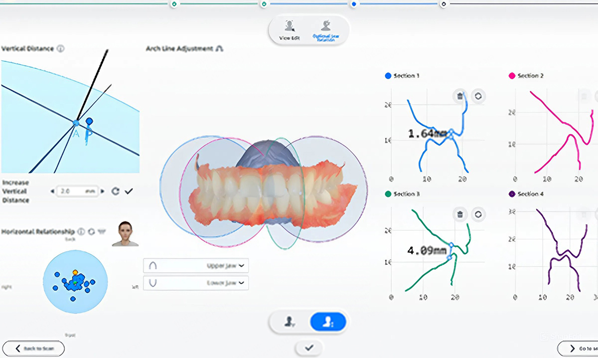 Анализ движений челюсти на графиках
