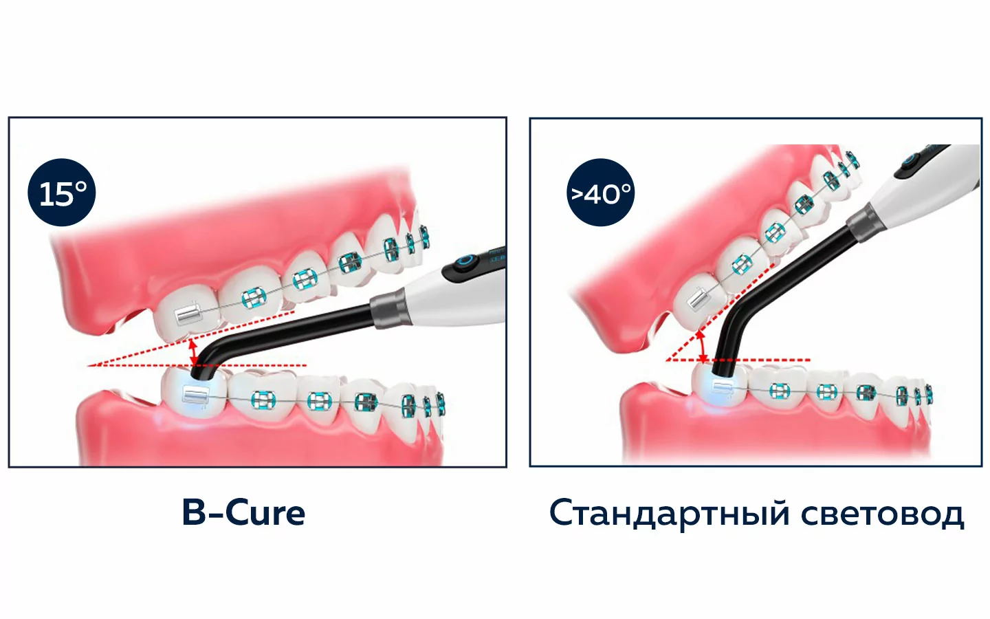 Эргономичный световод B-Cure