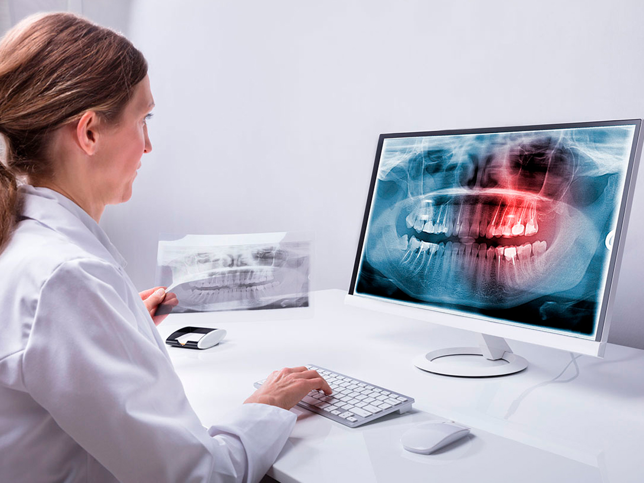 Искусственный интеллект в анализе стоматологических снимков КЛКТ