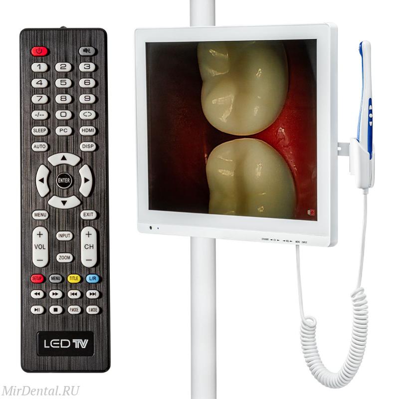 Интраоральная камера в стоматологии: принцип работы, типы, протоколы и нюансы выбора