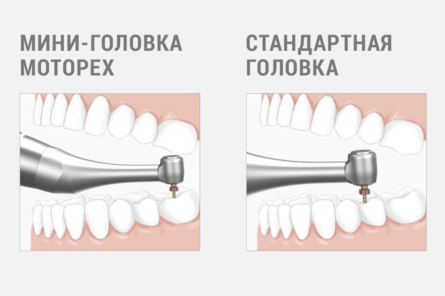 motopex-6.jpg