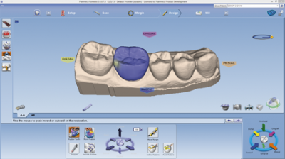 Planmeca CAD/CAM система для врача PLANMECA OY (Финляндия)