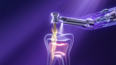 Endo GT Pro — Эндомотор с автоматическим определением крутящего момента и встроенным апекслокатором Woodpecker (Китай)  