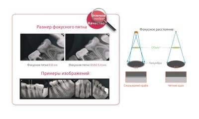 DVAS-M аппарат рентгеновский дентальный на мобильной стойке Genoray (Южная Корея)