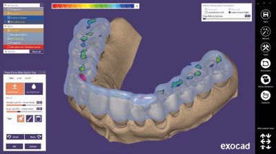 Exocad Bite splint module Модуль шинирования зубов Exocad