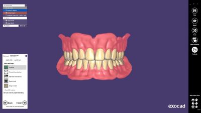 Exocad Full Denture Module Модуль полносъемных протезов Exocad