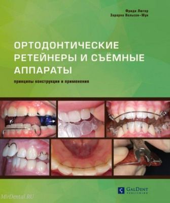 Лютер Ф., Нельсон-Мун З., Ортодонтические ретейнеры и съёмные ортодонтические аппараты. Принципы конструкции и применения.