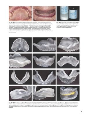 Накагоми Тасио ''Стандарт полного съемного зубного протеза'' Стом. издания
