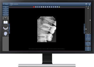 I-View Gold цифровой радиовизиограф Trident (Италия)  