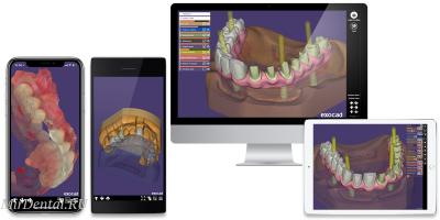 Exocad 2018 Valletta Программа автоматизированного моделирования для CADсистем