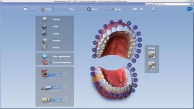 Planmeca CAD/CAM система для врача PLANMECA OY (Финляндия)