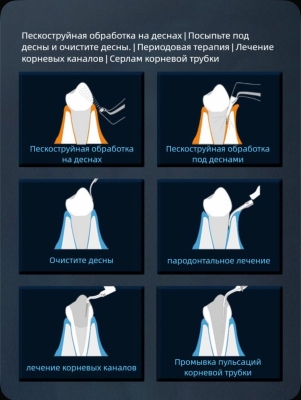 PT MASTER Ультразвуковой скалер с функцией воздушного полирования COXO (Китай)
