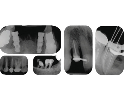 Reader Сканер с фосфорными пластинами Trident (Италия)  