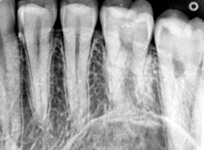 Lifedent Le Ray P Портативный рентген-аппарат Lifedent (Китай)