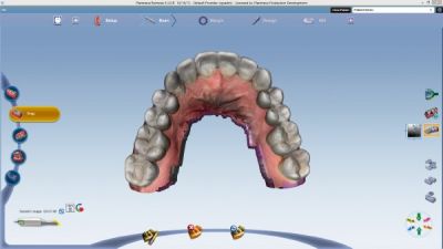 Planmeca PlanScan Интраоральный сканер PLANMECA OY (Финляндия)