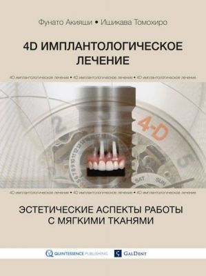 4D имплантологическое лечение:эстетические аспекты работы с мягкими тканями. Фунато Акияши, Ишикава Томохиро.