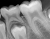 SOPIX 2 Стоматологический визиограф ACTEON Group | Satelec